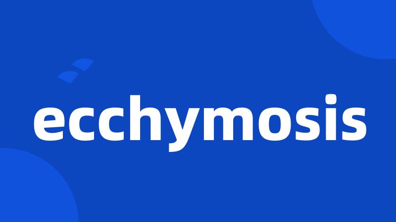 ecchymosis